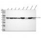 Anti-beta Tubulin Rabbit Monoclonal Antibody